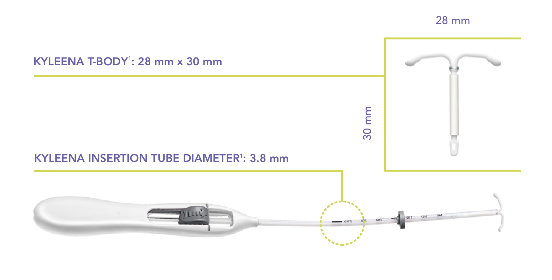 Graphic shows measurements of a Kyleena® (levonorgestrel-releasing intrauterine system) 19.5 mg IUD T-body (28 mm x 30 mm) and inserter (3.8 mm diameter).